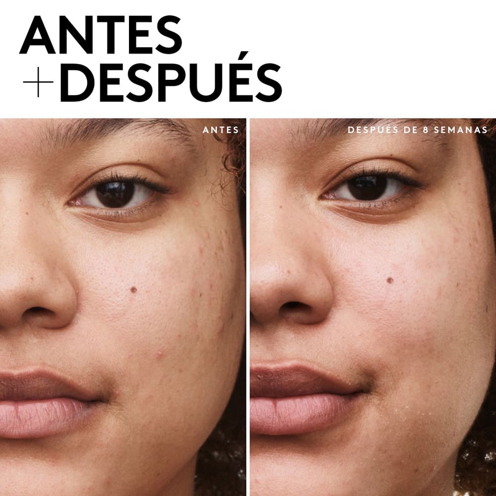 TOTAL CLEANS'R REMOVE-IT-ALL CLEANSER (LIMPIADOR FACIAL)